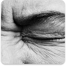 Eye Damage
